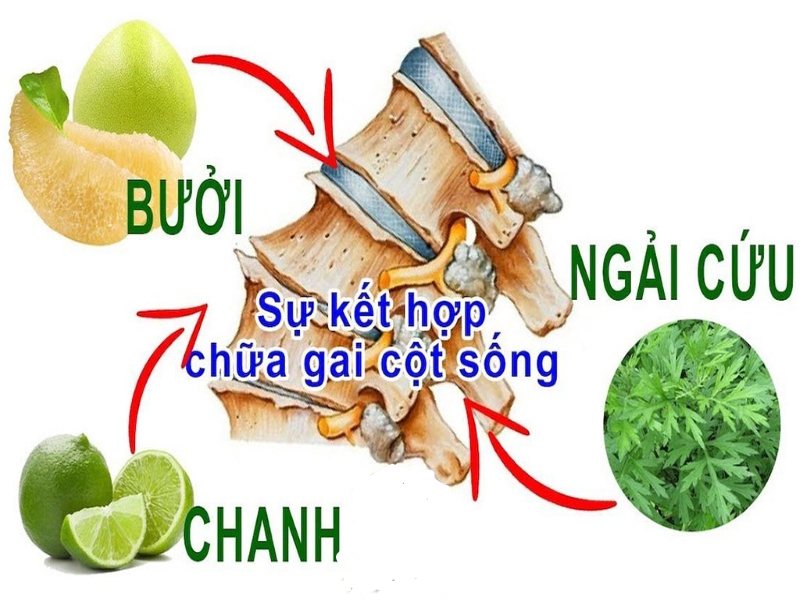 Bài thuốc dân gian giúp trị bệnh gai cột sống nhanh tại nhà